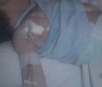 Técnica de enfermagem é suspeita de injetar leite na veia de bebê