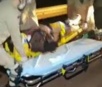 Racha na BR-163 deixa motociclista com perna dilacerada em Dourados