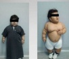 Criança de dois anos de idade com obesidade mórbida passa por cirurgia de redução de estômago