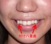 Nova tendência no Japão é ter dentes tortos.