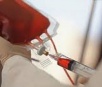 Novo teste torna mais eficaz a detecção dos vírus HIV e da hepatite C