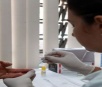 Curitiba realiza testes rápidos para HIV até sexta-feira