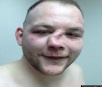 Lutador de MMA exibe nariz quebrado em rede social e imagem bomba na internet. 