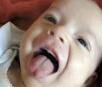 Fonoaudióloga defende obrigatoriedade do teste da linguinha em recém-nascido