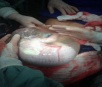 Médico grego registra o momento em que bebê nasce com seu saco amniótico