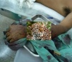 Onça-pintada quebra o braço de vaqueiro que é salvo por vira-latas, em Cáceres