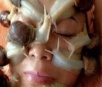 Salão de beleza coloca caracóis no rosto de paciente para tratamento de pele