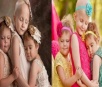 Três meninas pacientes de câncer em remissão recriam foto viral