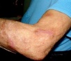 Idosa de 68 anos é agredida por mulher em Itaporã