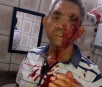 Professor idoso é agredido a socos dentro de sala de aula por aluno em Lins-SP