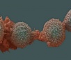 Cientistas espanhois removem a ‘imortalidade’ das células de câncer