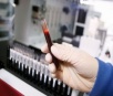 Laboratório Municipal de Itaporã não está realizando exames de sangue