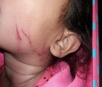 Descontrolada, mãe é presa em Dourados por puxar cabelo e agredir a filha de 4 anos