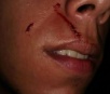Com socos, tapa e taco de sinuca homem é agredido em bar de Itaporã