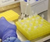 Brasil segue com nove casos suspeitos de coronavírus